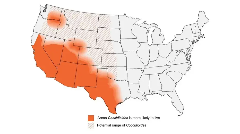 Coccidioides can be found in most areas of the United States' east, exposing many to the dangerous condition (CDC)