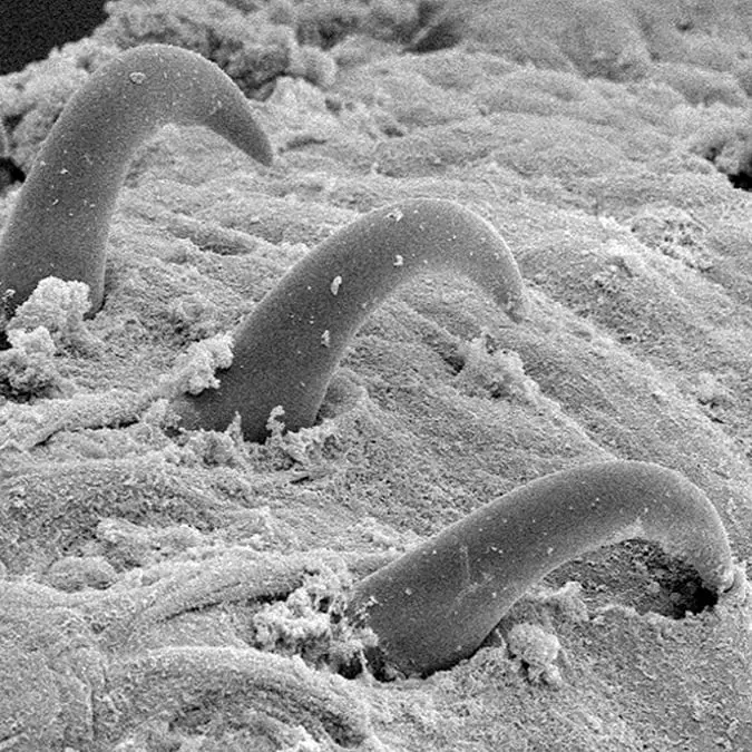 People horrified after discovering what a tapeworm looks like under a microscope