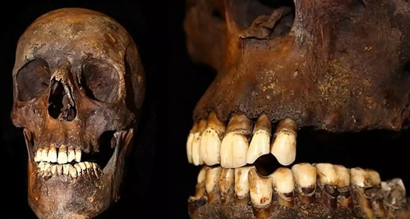 Researchers from the University of Leicester have taken a look at the impact smoking has on your bones in the long term (University of Leicester)