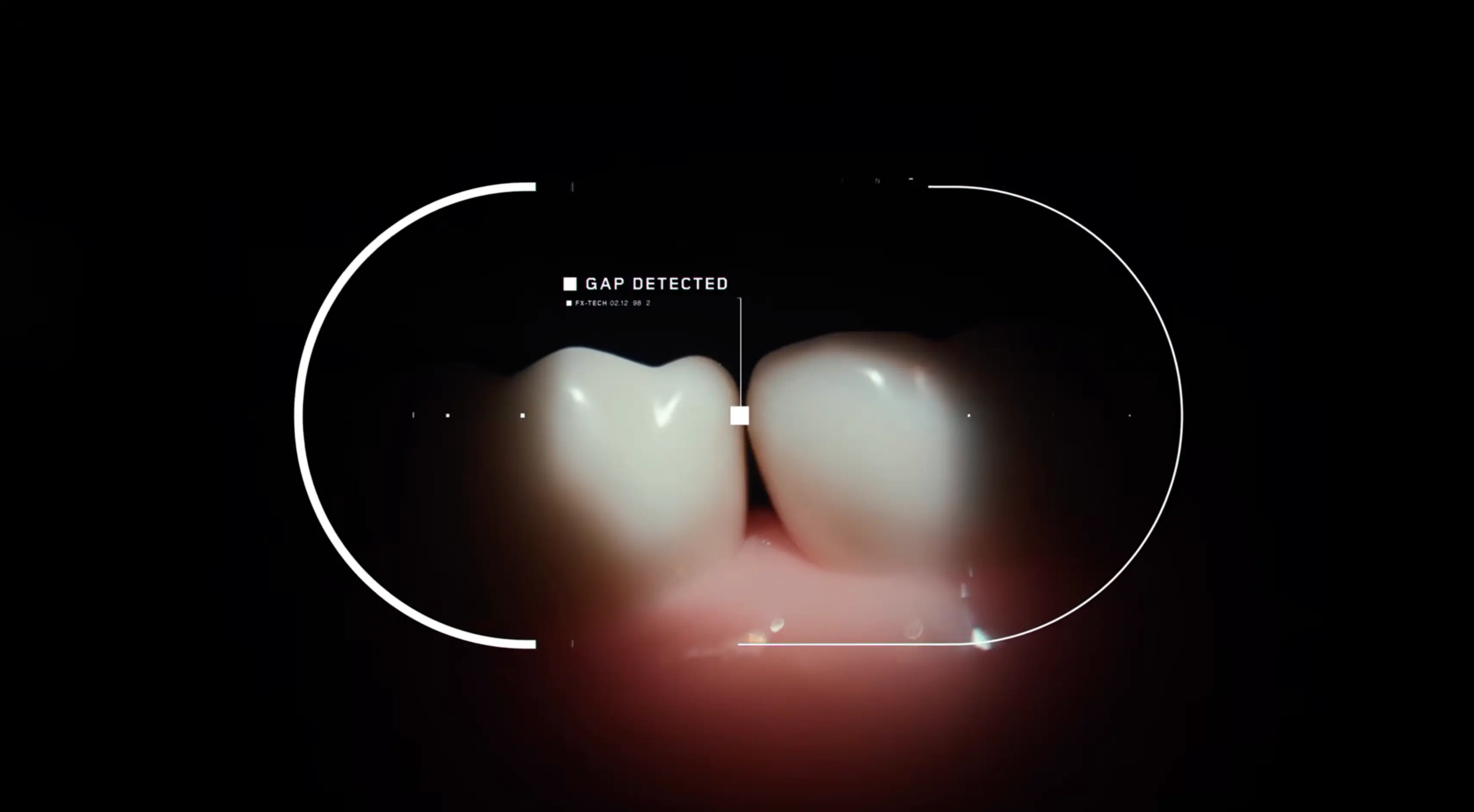 The camera is powered by Gap Optical Targeting™ to identify gaps between teeth (Dyson)