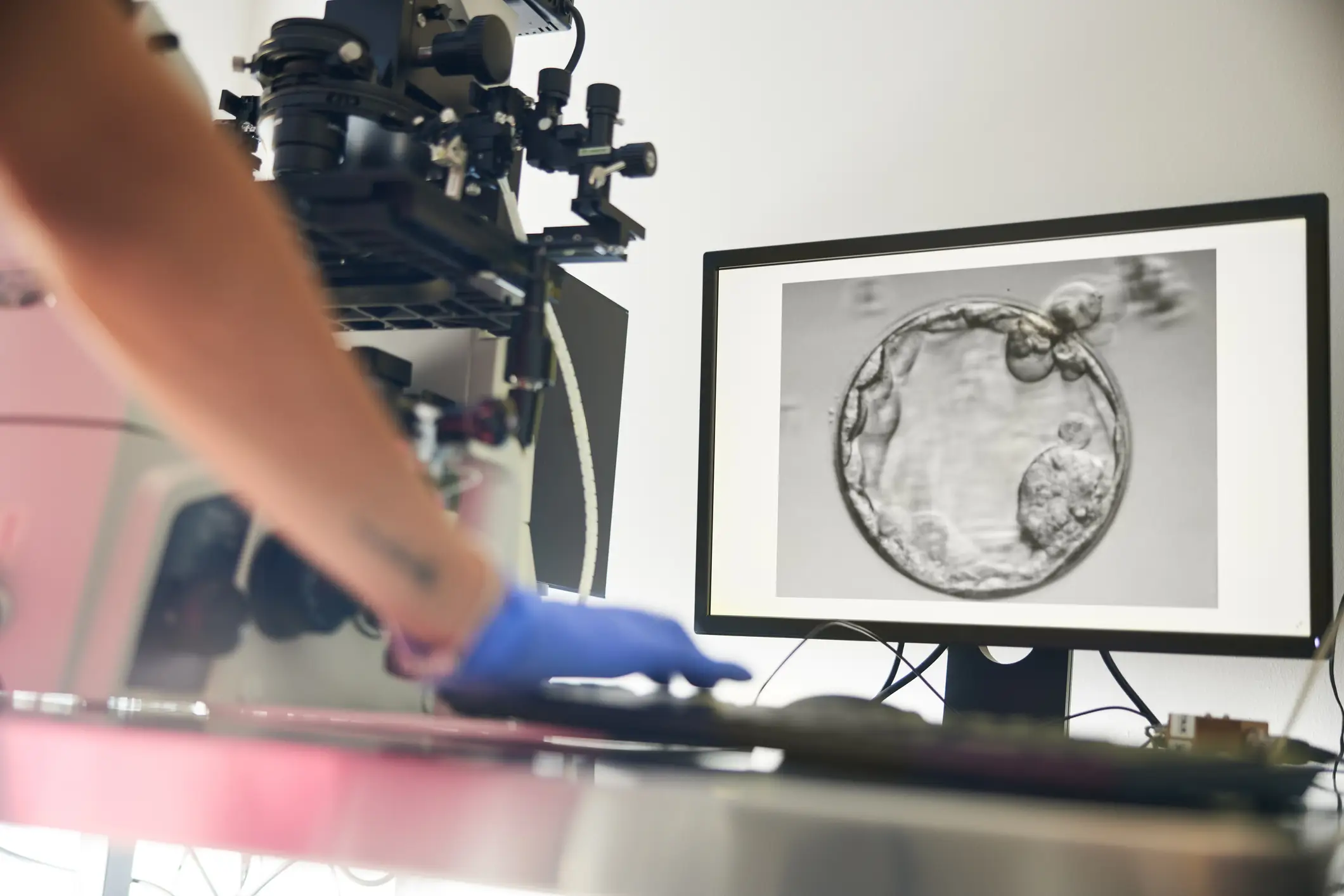 Scientists have discovered a new way to create human eggs from skin cells (Tempura/Getty Images)