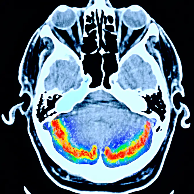 Peter Dazeley / Getty