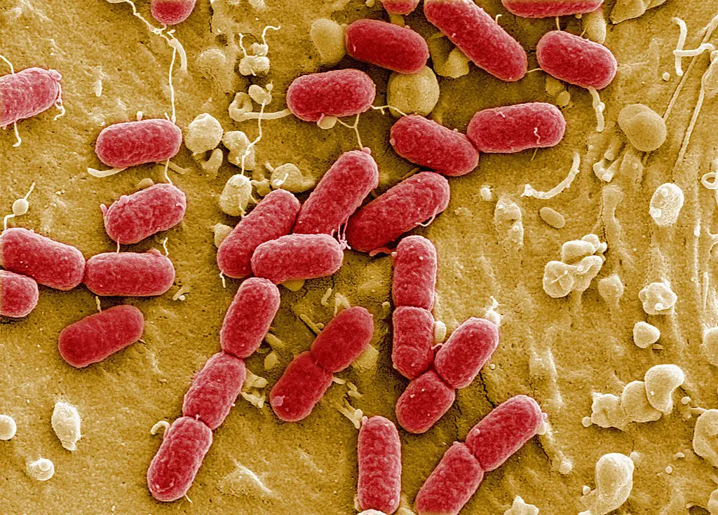 Microorganisms in the trillions could cling to our bodies and disrupt ecosystems in space (Manfred Rohde, Helmholtz-Zentrum fuer Infektionsforschung (HZI)/Getty Images)