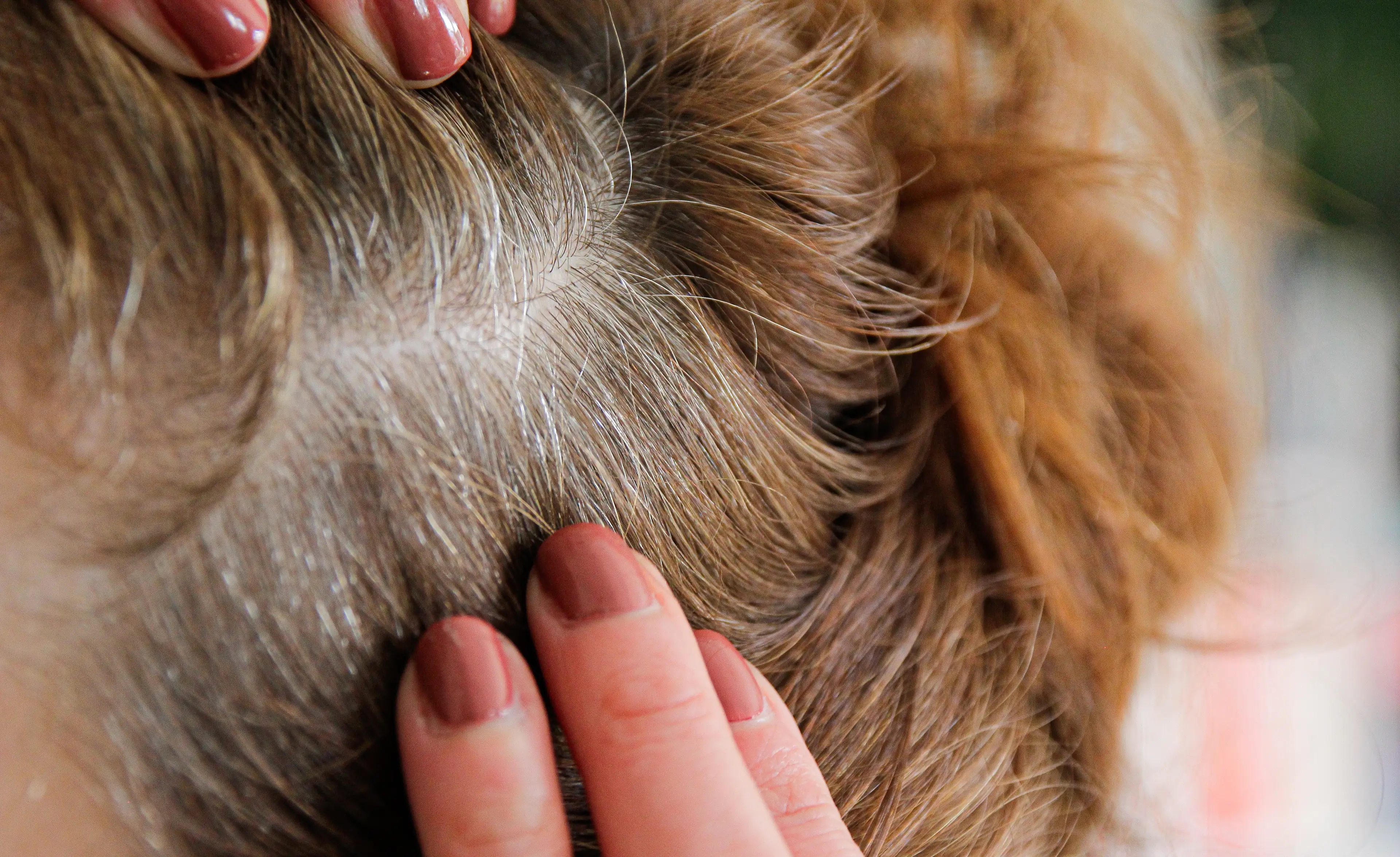 Think about this next time you spot a grey hair. (Getty Stock Images)