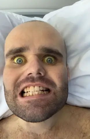 Holland said his skin turned yellow as his organs began failing (Kennedy News and Media)