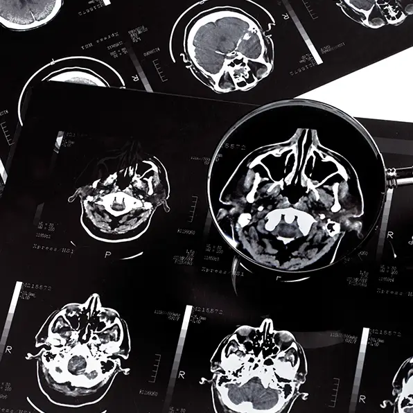 Peter Dazeley / the_burtons / Getty