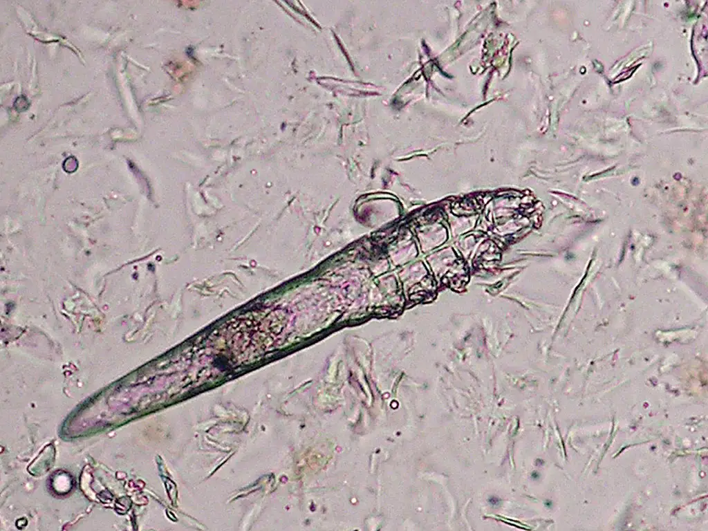 For such tiny creatures, Demodex mites can cause big problems (Agency-Animal-Picture / Contributor / Getty)