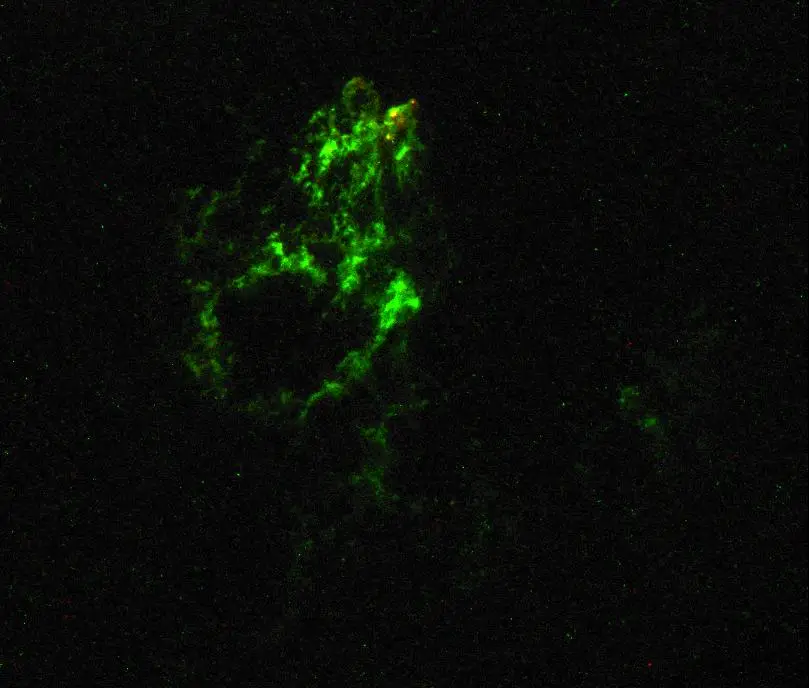 This glowing green space object has been described as 'strangely alive' (NASA, ESA, W. Keel (University of Alabama), Galaxy Zoo Team)