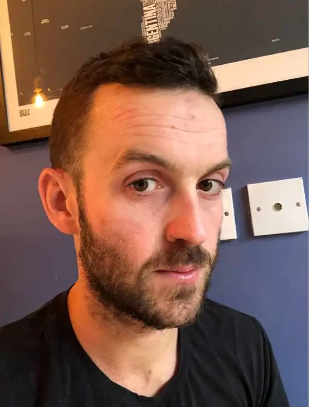 His skin more recently.