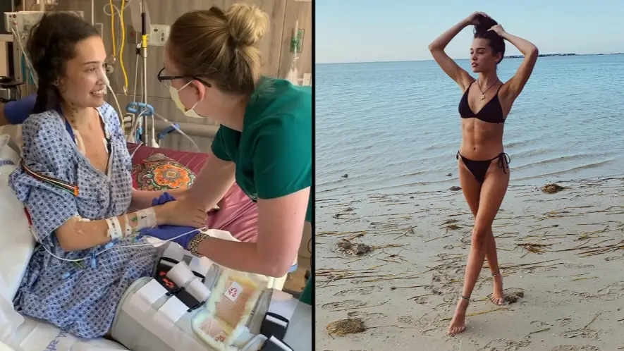 Aspiring Model Loses Her Legs Due To Covid-19 Complications